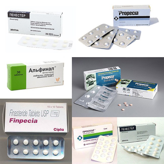 Препарати на основі фінастерида: Альфінал, Пенестер, Проскар, Фінпеція, Пропеція